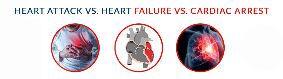 Heart Attack vs. Heart Failure vs. Cardiac Arrest